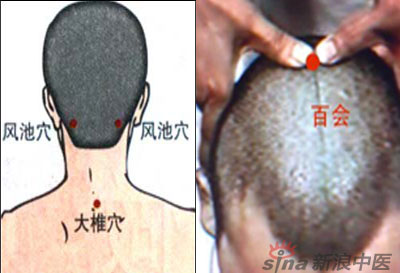 常見病艾灸時怎樣選穴？--大椎百會穴