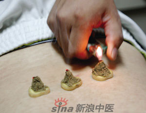 灸法的種類  你知道多少？